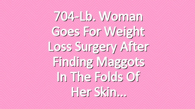 704-Lb. Woman Goes for Weight Loss Surgery After Finding Maggots in the Folds of Her Skin