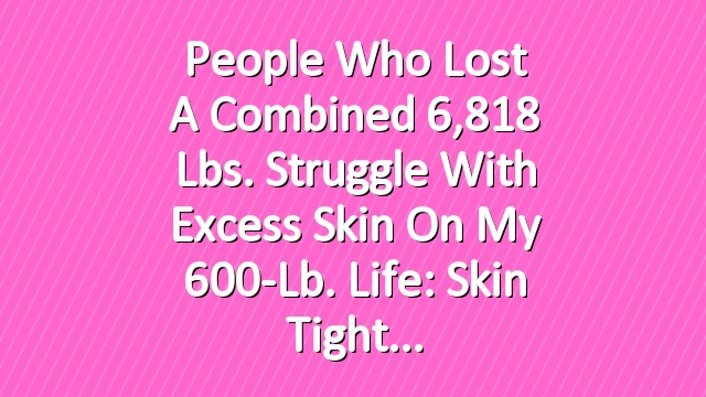 People Who Lost a Combined 6,818 Lbs. Struggle with Excess Skin on My 600-Lb. Life: Skin Tight